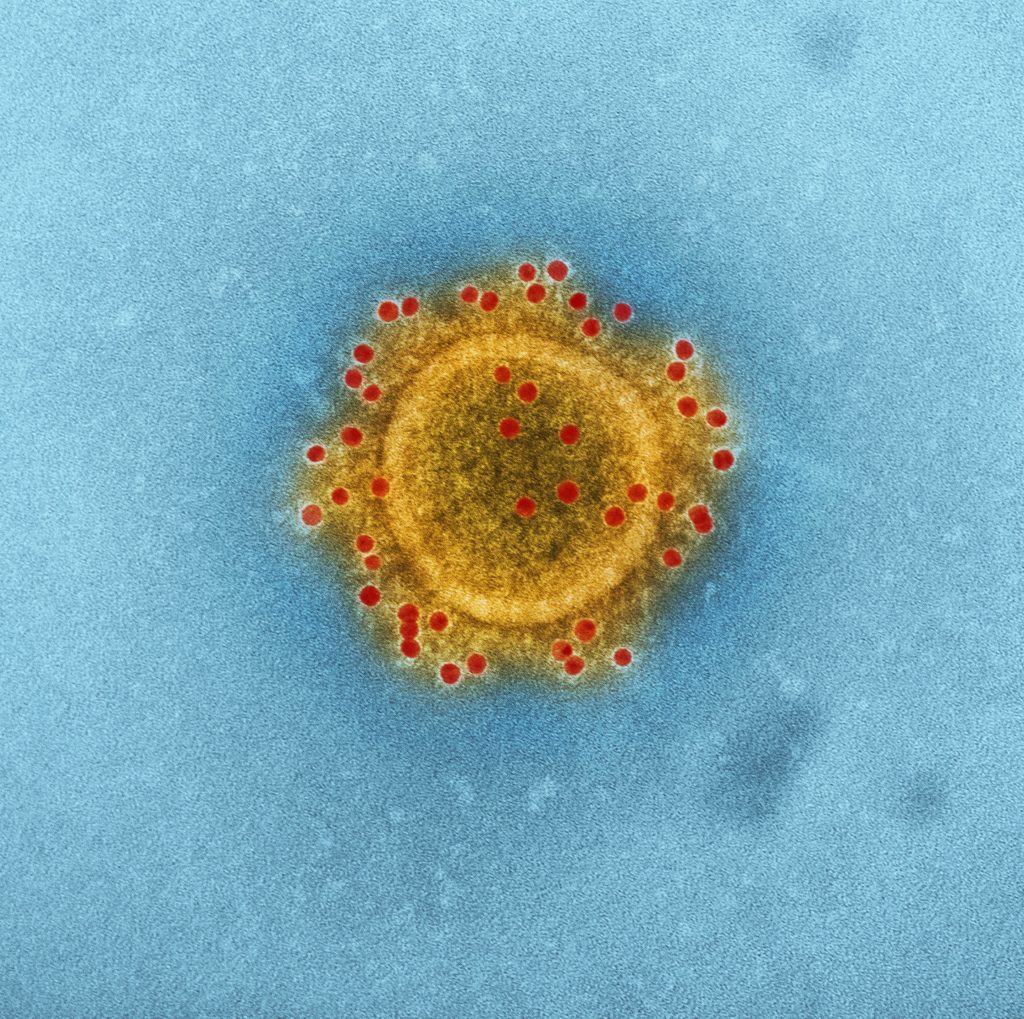 Coronavirus particle