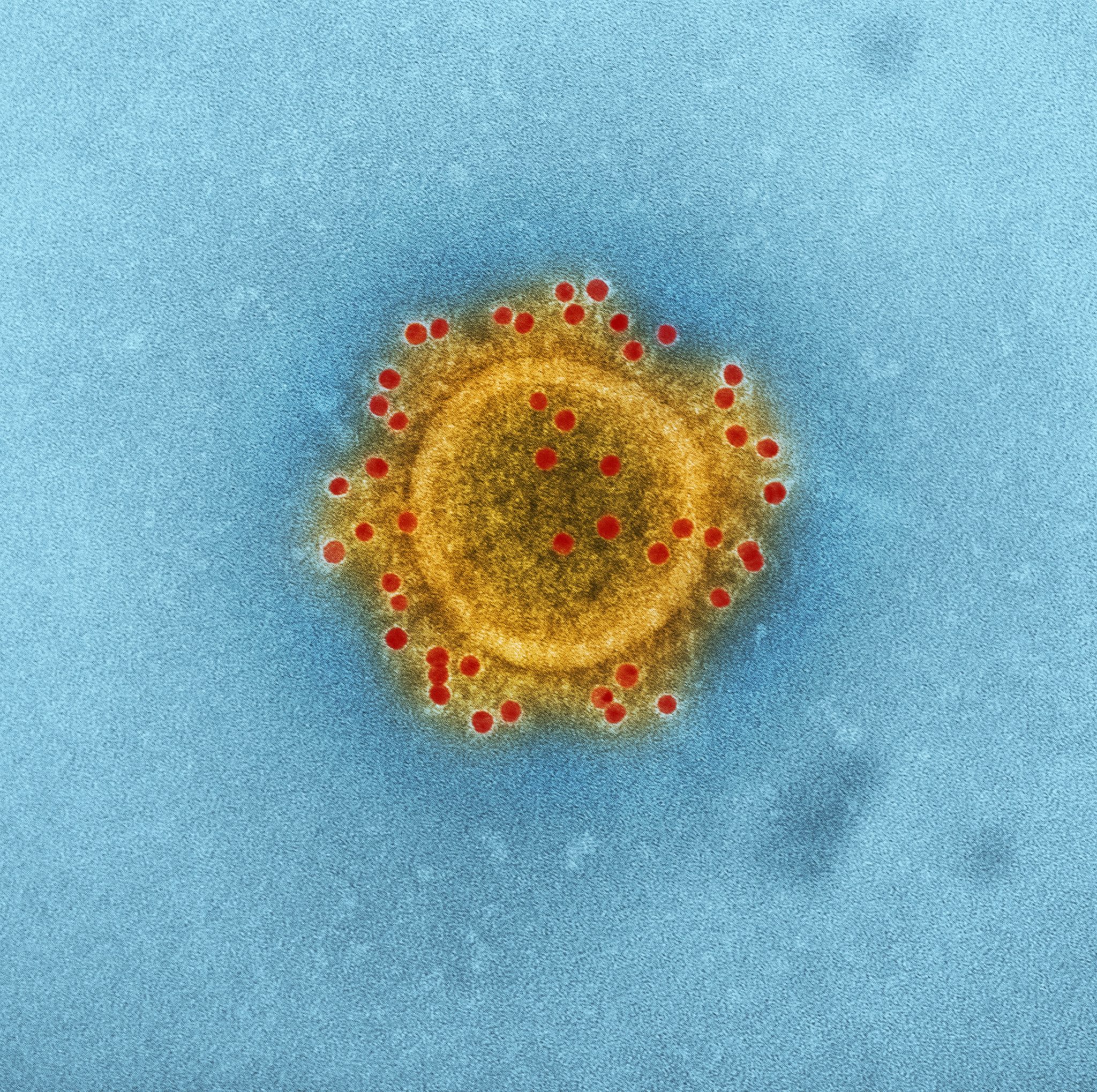 Cómo pueden responder las iglesias al coronavirus